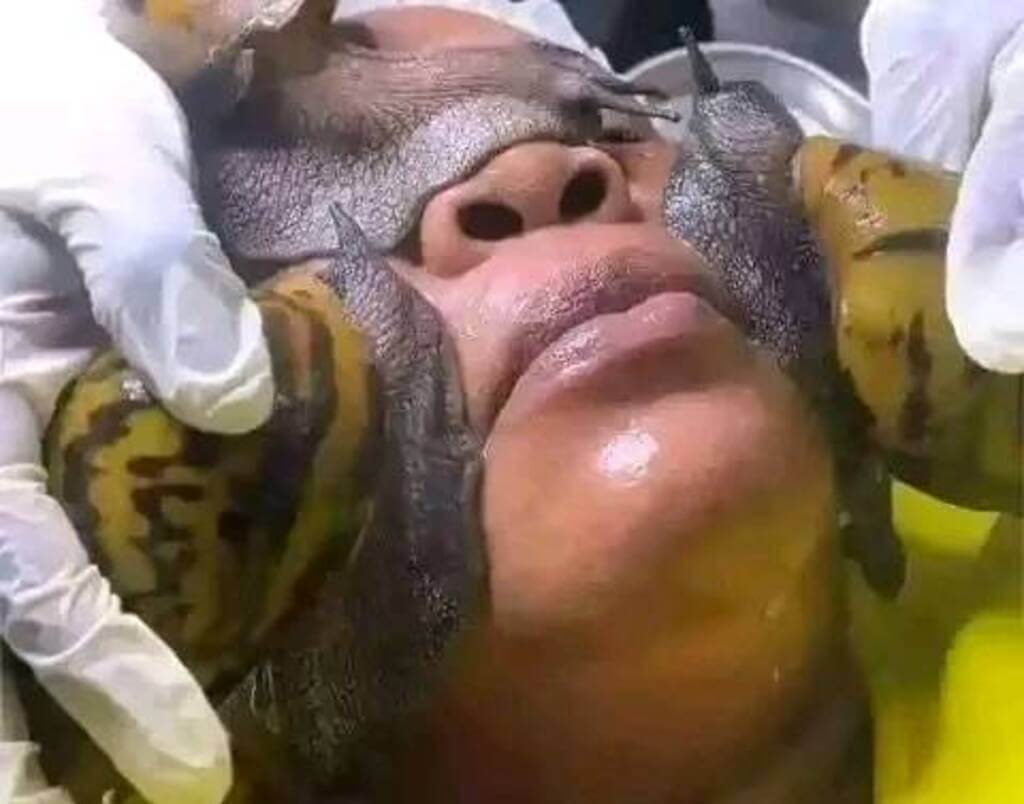 snail slime